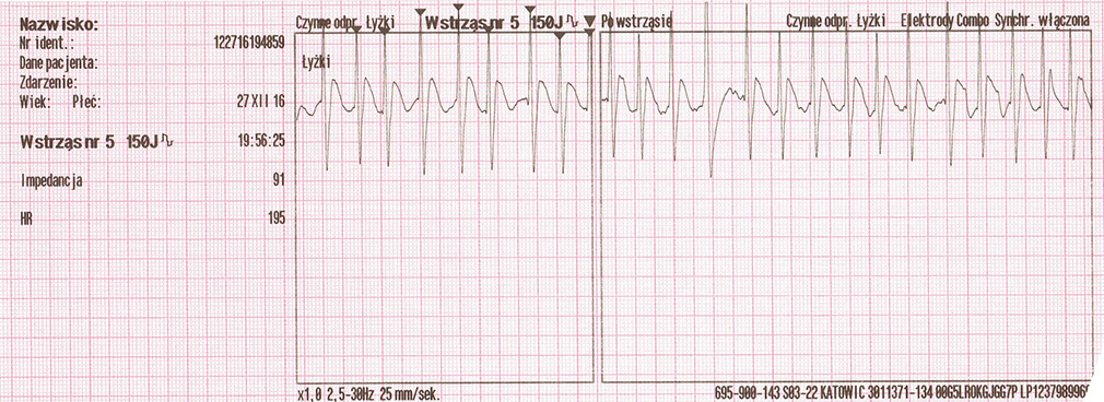 NAR_1_17_WYKORZYSTANIE_NOWYCH_UPRAWNIEN_RATOWNIKA_RYC_2