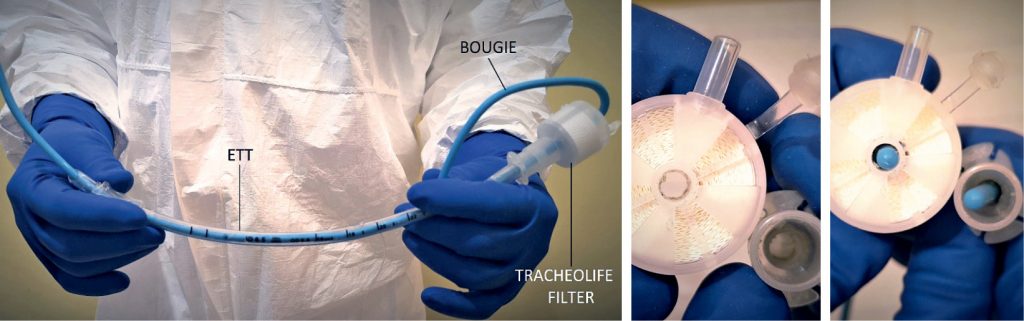 NAR_3_20_wiedza_w_praktyce_PRZEDSZPITALNE_SPOSOBY_PROWADZENIA_TLENOTERAPII_UDROZNIENIE_DROG_ODDECHOWYCH_PACJENT_Z_COVID_FOT_9