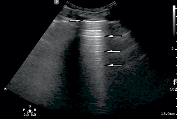 NAR_6_20_wiedza_w_praktyce_DIAGNOSTYKA_ROZNICOWA_PRZYCZYN_DUSZNOSCI_RYC_3_A