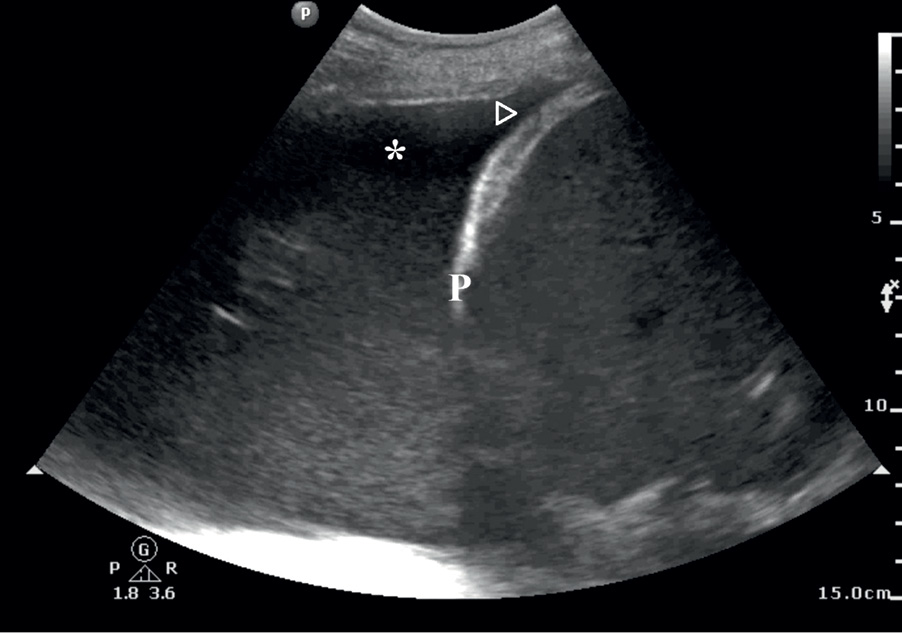 NAR_6_20_wiedza_w_praktyce_DIAGNOSTYKA_ROZNICOWA_PRZYCZYN_DUSZNOSCI_RYC_4_A