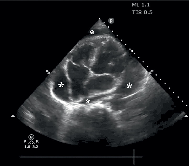 NAR_6_20_wiedza_w_praktyce_DIAGNOSTYKA_ROZNICOWA_PRZYCZYN_DUSZNOSCI_RYC_4_B