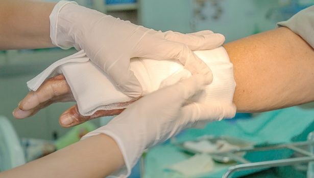 Oparzenia skóry - zagrożenie dla zdrowia i życia pacjenta