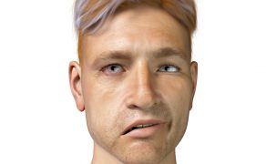 NAR_4_22_Jakub_Bilas_JAK_SIE_OBJAWIA_PORAZENIE_NERWU_TWARZOWEGO_iStock-1314471102