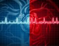 NAR_5_25_wiedza_w_praktyce_Michal_Kucap_STANY_NAGLE_W_EKG_iStock-947331372